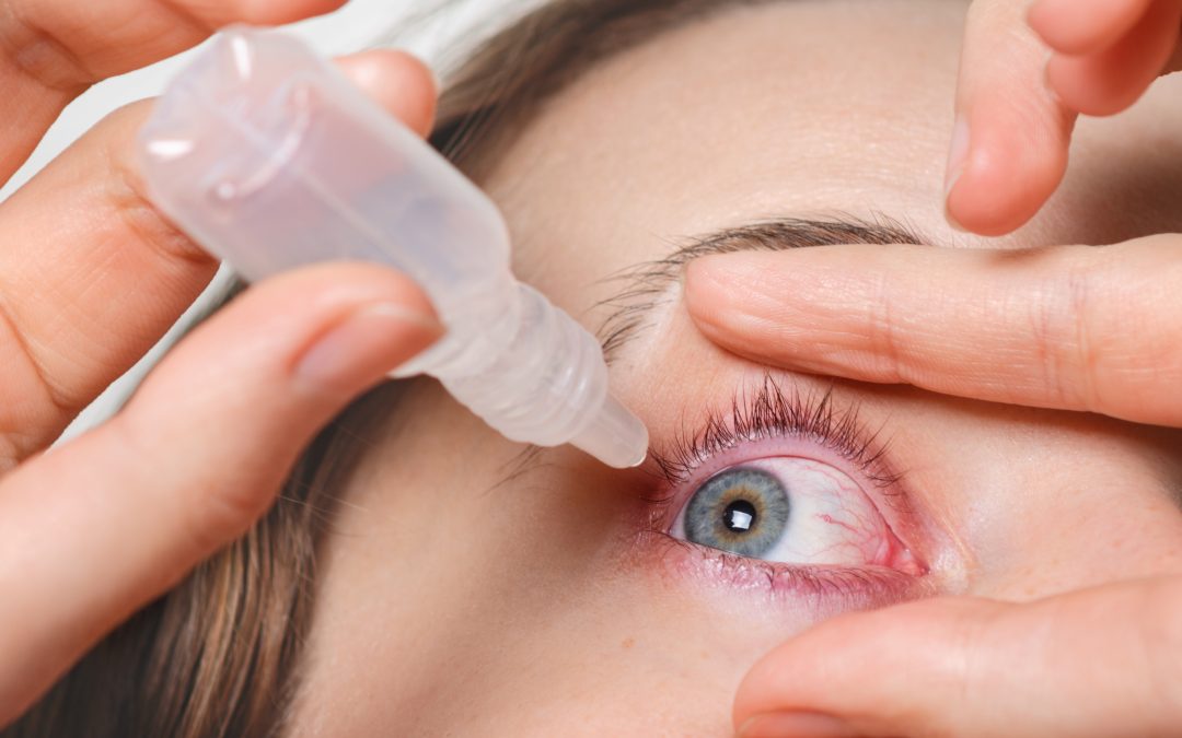 What is Post-LASIK “Dry Eye” and How Can I Prevent It?
