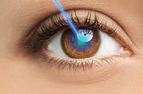 Is Laser Eye Surgery Painful?