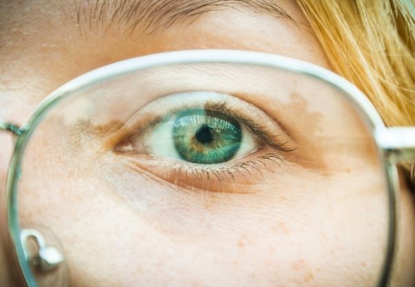 Do You Need Lens Exchange Image