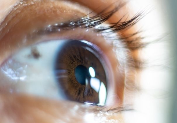RLE Permanently Removes the Natural Lens Image