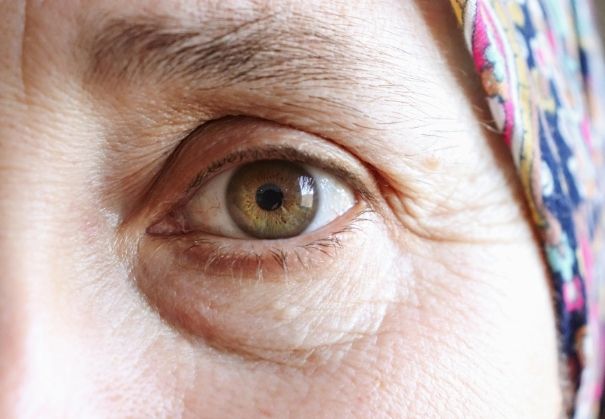 What Are the Potential Risks of RLE Image